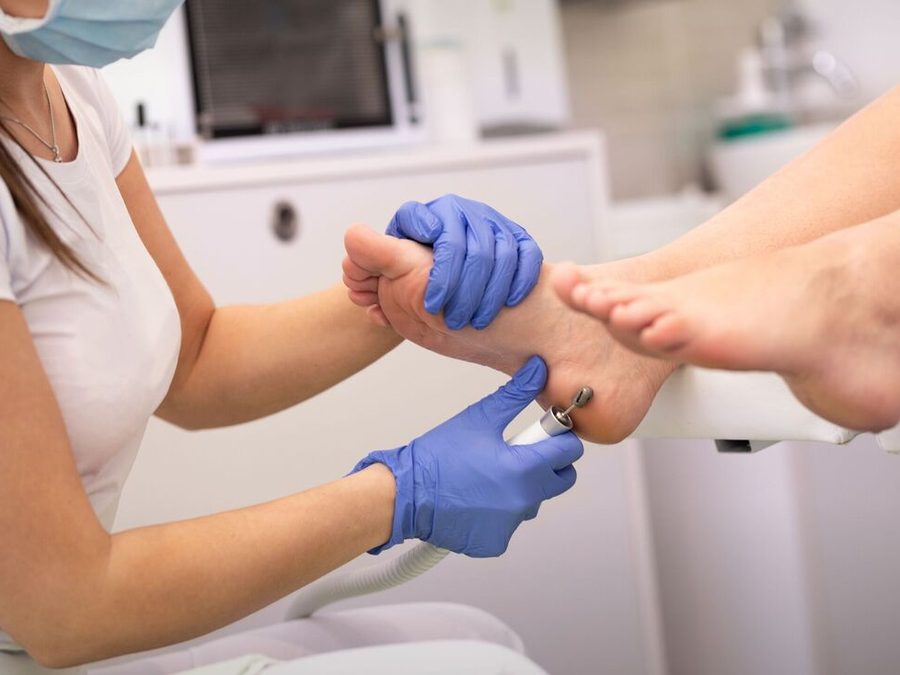 Podóloga realizando procedimento no calcanhar de uma cliente