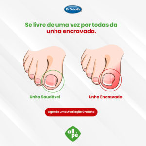 anuncio_allpe