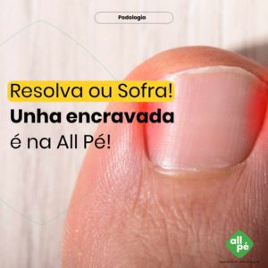 unha_encravada_Padrão de Post - ALLPE - Carrossel 2020