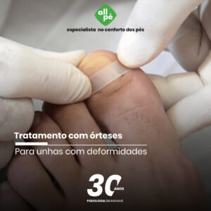 ortese_Padrão de Post - ALLPE - Carrossel 2020